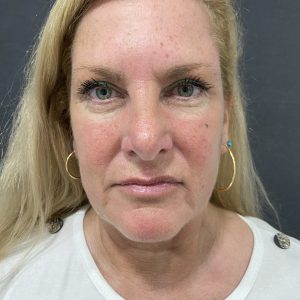 IMG_0786