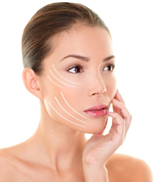 Lifting Facial: ¿Deep Plane, SMAS o Mini? El Secreto de un Rostro Joven