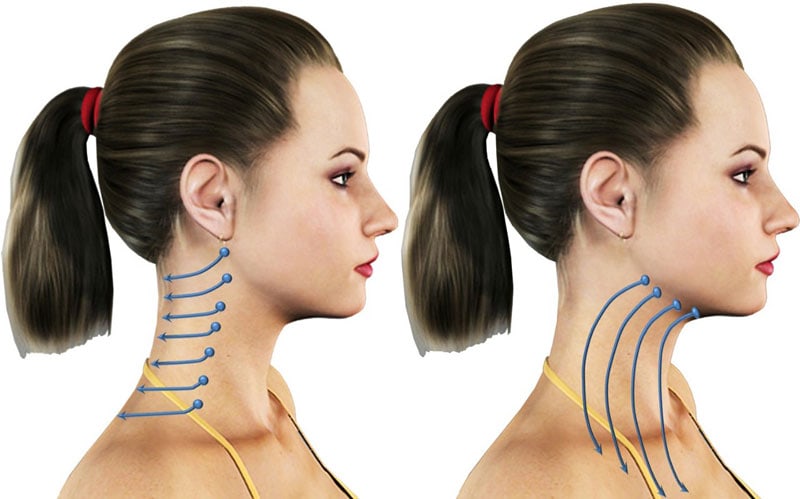 Lifting de cuello: cuándo está indicado y resultados naturales