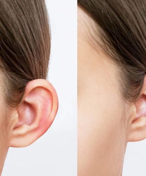 876f33e258bf36f1c61c92944293a505